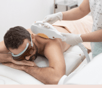 IPL Hair removal